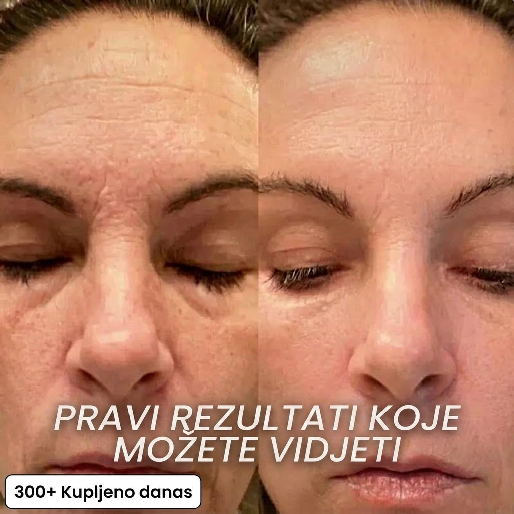 Regenerativni stick s Bio-kolagenom i PDRN-om