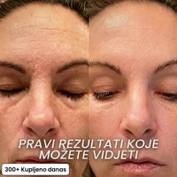 Regenerativni stick s Bio-kolagenom i PDRN-om