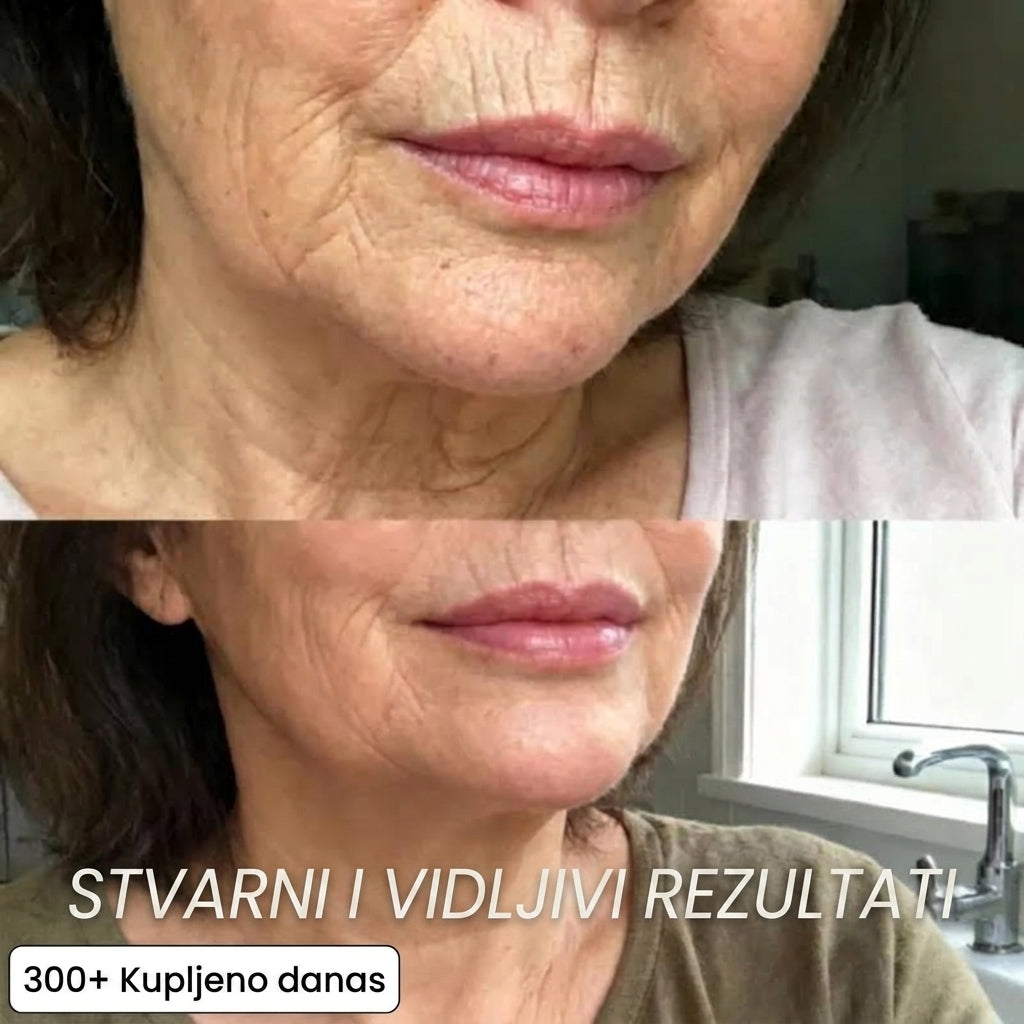 Regenerativni stick s Bio-kolagenom i PDRN-om