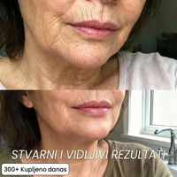 Regenerativni stick s Bio-kolagenom i PDRN-om